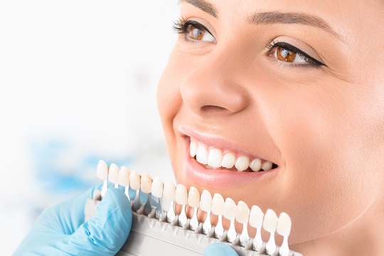 woman smiling porcelain veneers